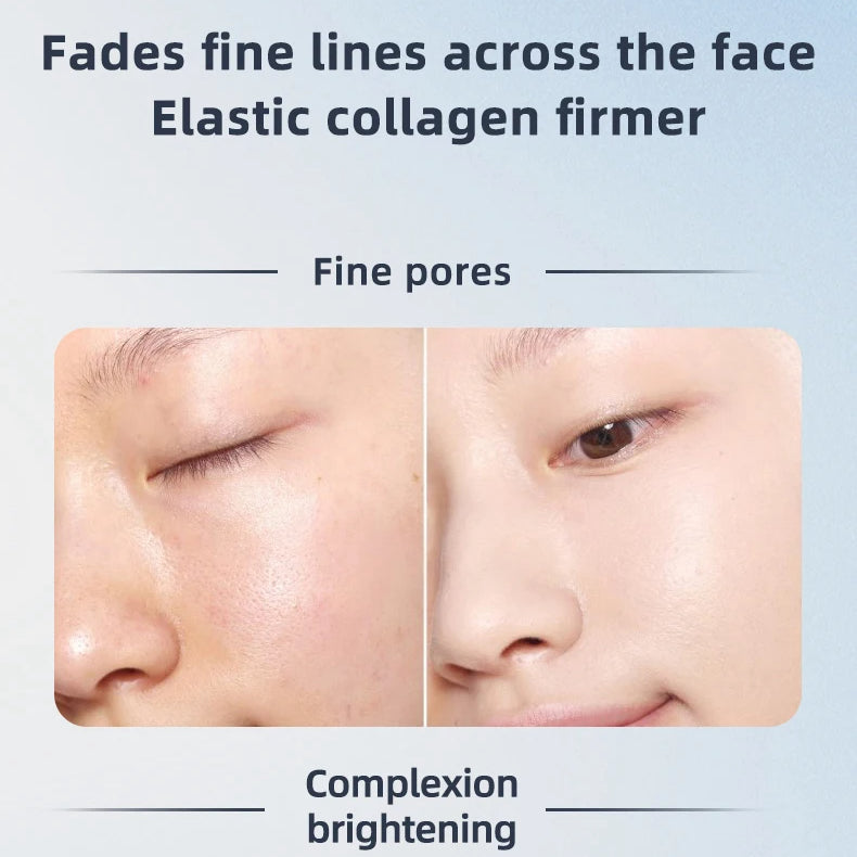 3-in-1 RF EMS Facial Roller | 360° Massager with LED & Heat | Anti-Wrinkle Skin Tightening Device for Face & Body