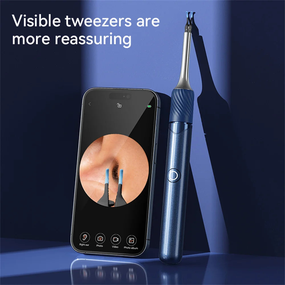 Ear Wax Removal Tool with Camera | 12MP HD Wi-Fi Otoscope for iPhone & Android | LED Light, 3-in-1 Spoon, Pick & Tweezer Kit