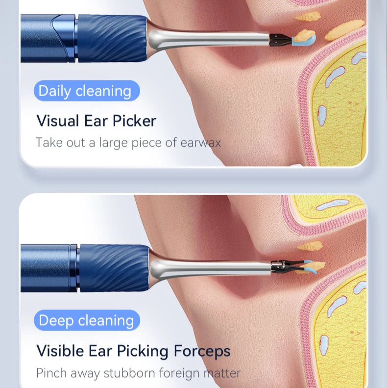 Ear Wax Removal Tool with Camera | 12MP HD Wi-Fi Otoscope for iPhone & Android | LED Light, 3-in-1 Spoon, Pick & Tweezer Kit
