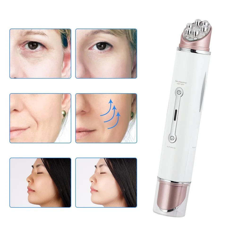 Heated EMS LED Eye Massager | Photon Therapy, Anti-Wrinkle, Eye Bag Remover, Face Lifting Wand – 3 Light Modes, Hot Compress