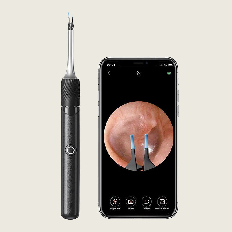 Ear Wax Removal Tool with Camera | 12MP HD Wi-Fi Otoscope for iPhone & Android | LED Light, 3-in-1 Spoon, Pick & Tweezer Kit