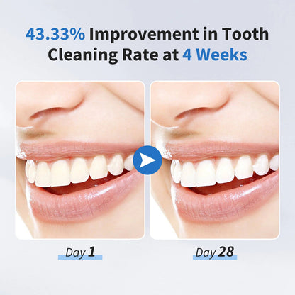 Sonic Electric Toothbrush for Adults | 37,200 VPM, 5 Modes | 12 Brush Heads, 30-Day Battery, IPX7 Waterproof, 2-Minute Timer