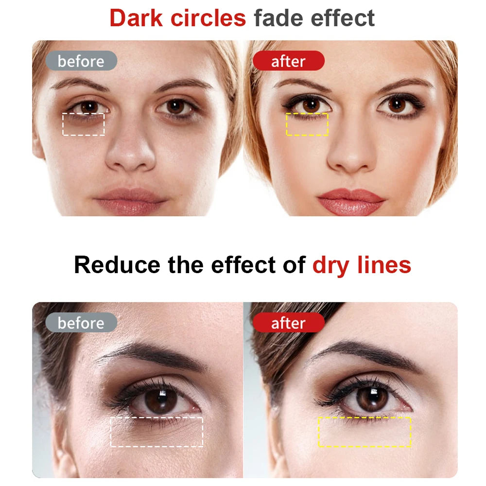 Electric Eye Massager Pen | RF Radio Frequency, Red Light, EMS & Vibration | Anti-Wrinkle, Dark Circles, Eye Bag Remover