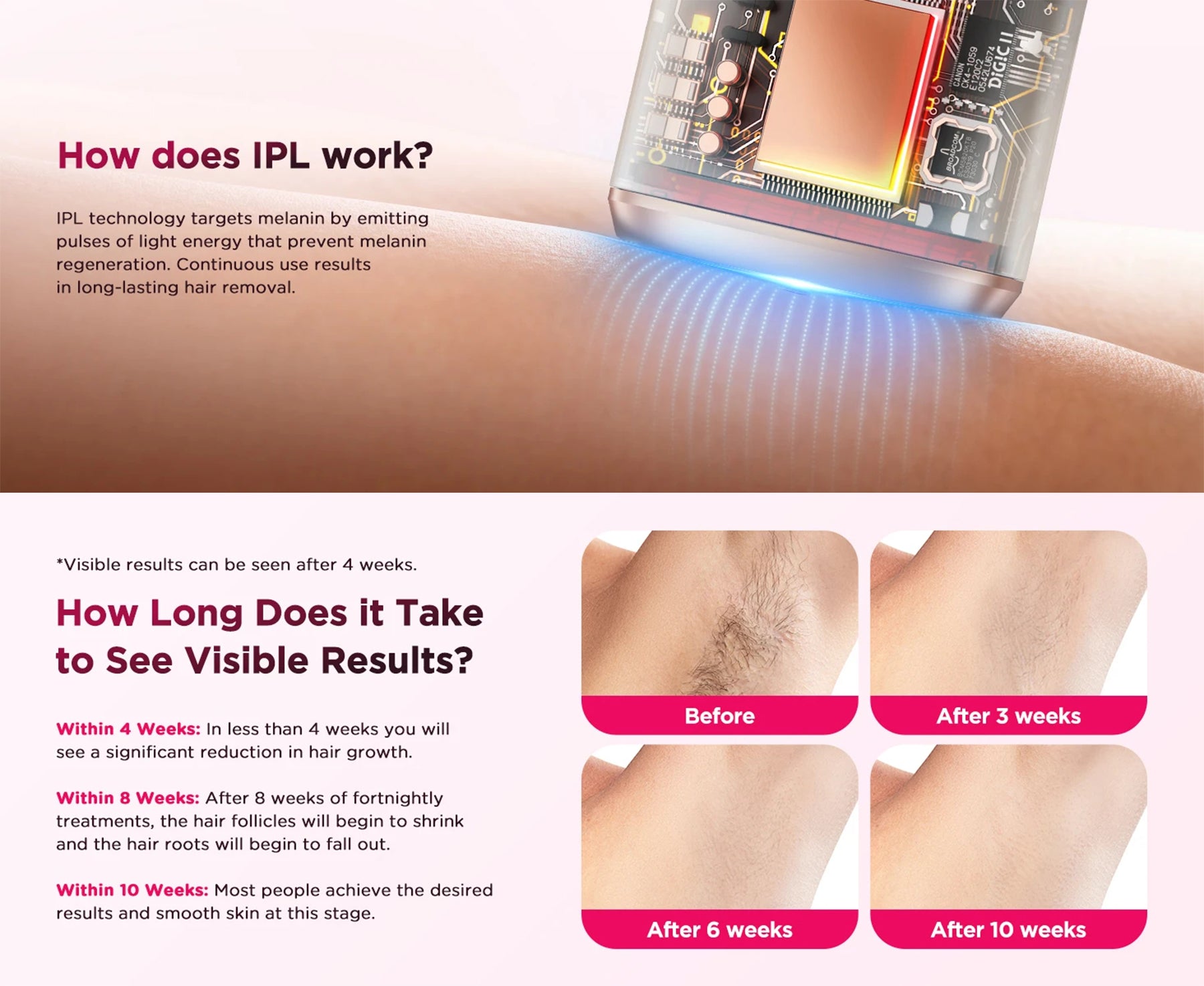IPL Hair Removal Device | 999,900 Flashes, 8-Week Results, Auto-Glide Laser Epilator for Face, Body, Bikini – Painless & Safe