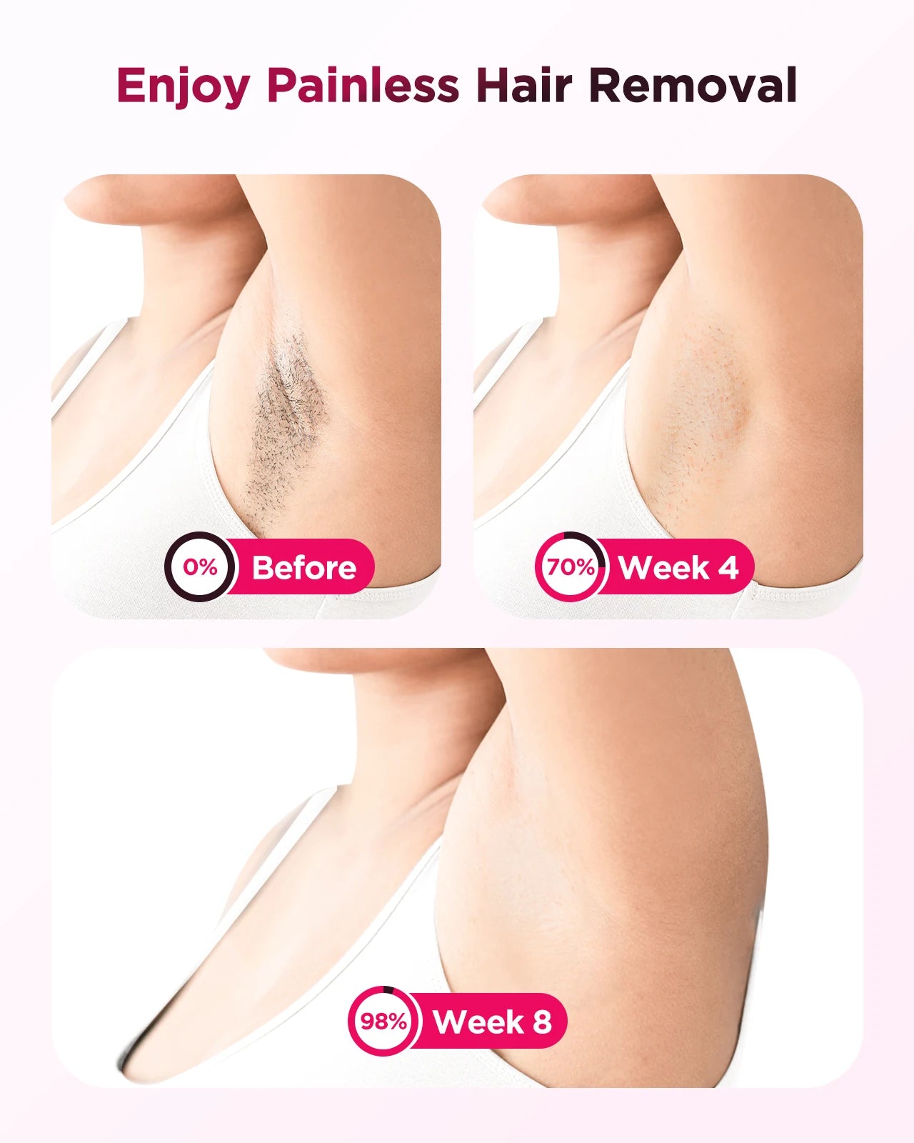 IPL Hair Removal Device | 999,900 Flashes, 8-Week Results, Auto-Glide Laser Epilator for Face, Body, Bikini – Painless & Safe