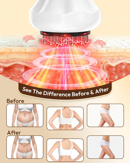 Lymphatic Drainage Body Massager – Heated Vibration Tool