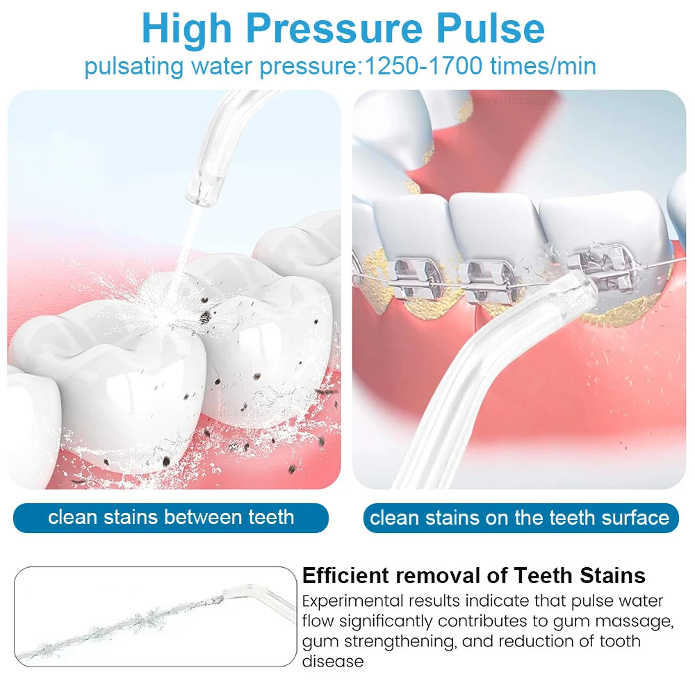 Professional Oral Irrigator | 1800 Pulses/min, 800ml Tank, 5 Tips & Adjustable Pressure | Electric Water Flosser for Braces, Implants & Gum Health